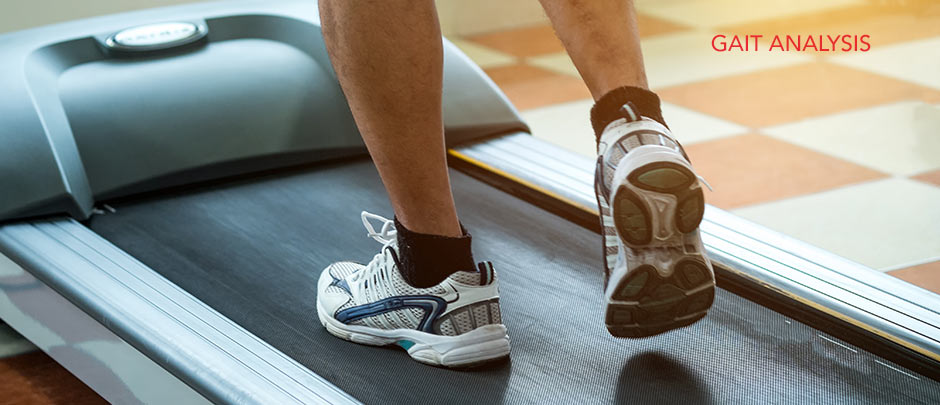 A man running on a treadmill- gait analysis